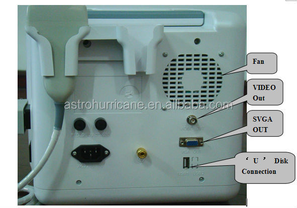 B超音波診断システム|chinab超音波スキャナ仕入れ・メーカー・工場