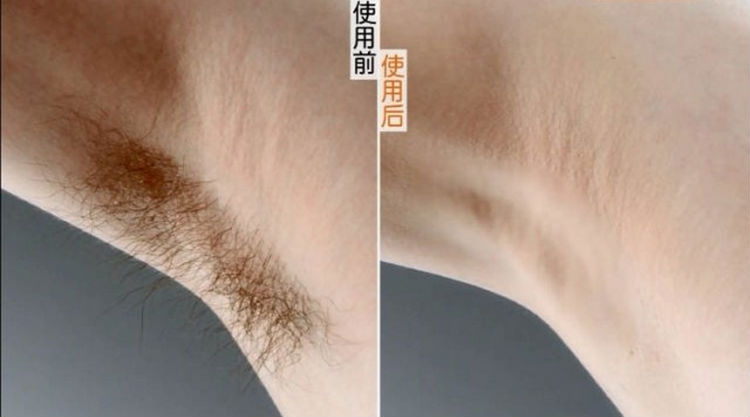 スライドをレジスト、 脱毛クリーム男性女って用のみg1018oem問屋・仕入れ・卸・卸売り