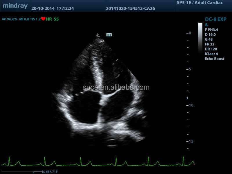 フルデジタルmindray高- グレードカラードップラー超音波診断機器仕入れ・メーカー・工場