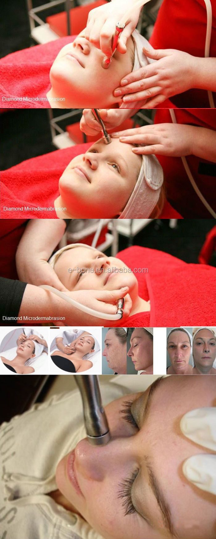 1の8facailプロのケアマシンキャビテーション治療光子スキンスクラバーダイヤモンドの皮膚剥離のmicrodermabrasionのマシン問屋・仕入れ・卸・卸売り