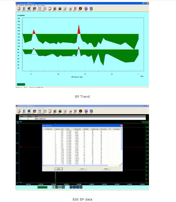 時間の録音abpモニター24abpm自由行動下24時間血圧モニターbpのモニター無料でアナライザソフトウェア仕入れ・メーカー・工場