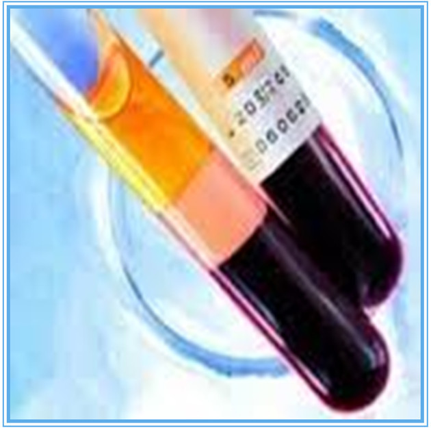 高品質の水- 溶血液の試験管シリサイド用剤仕入れ・メーカー・工場