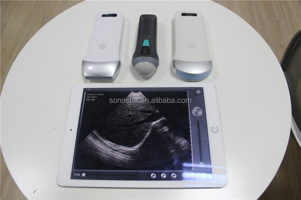 Hanheld Wireless Ultrasound Working On Iphone & Ipad (uprobe1) Buy