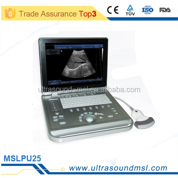 (mslpu31f) 医療機器ワイヤレスusg超音波プローブマシン用の妊娠検査仕入れ・メーカー・工場