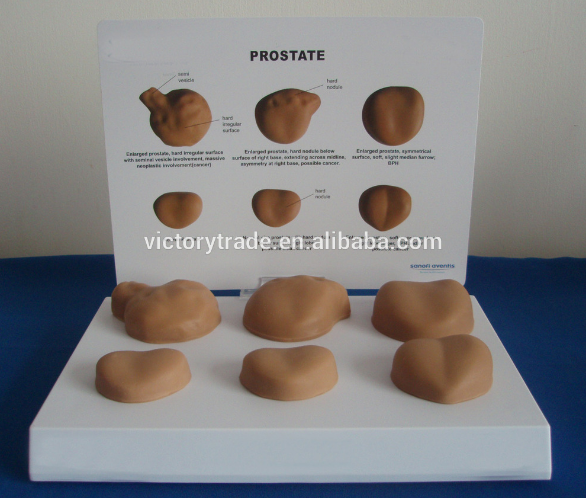 V Am031 Human Prostate Gland Disease Anatomy Model With Accessory Piece