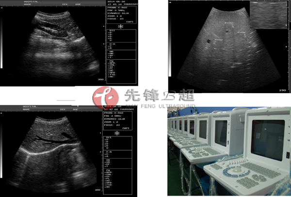 中国xf-218crtフルデジタルポータブル超音波スキャナに使用できますが、 産婦人科を調べる仕入れ・メーカー・工場