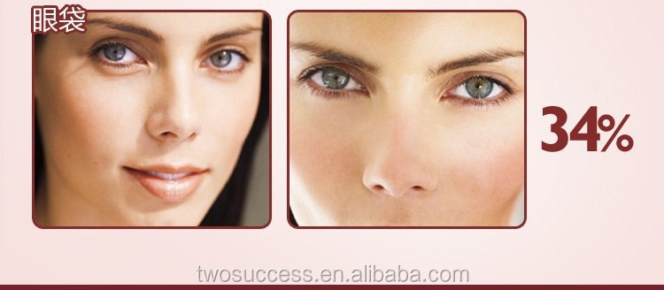 Electric Eye Wrinkle Eye Bags Remover Machine .jpg