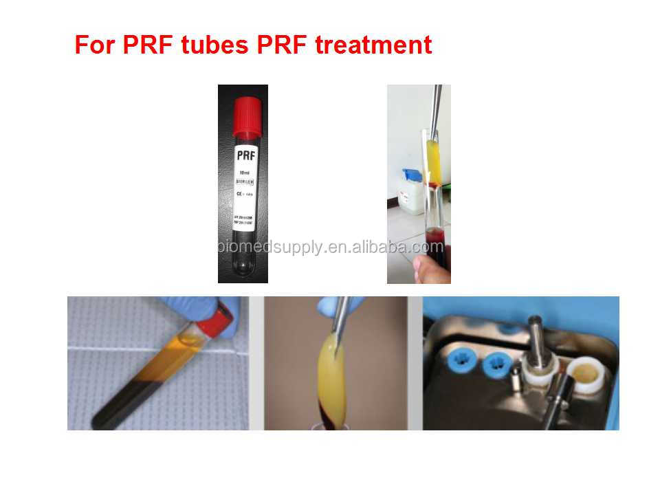 PRF TUBES.jpg
