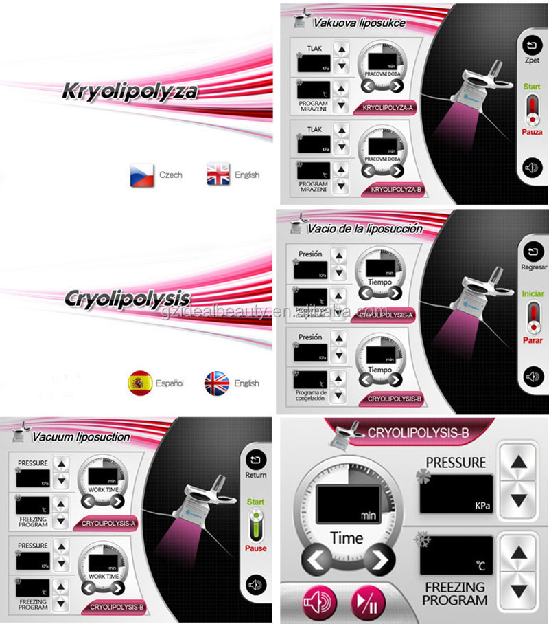 のcryolipolysis痩身機( s041)問屋・仕入れ・卸・卸売り