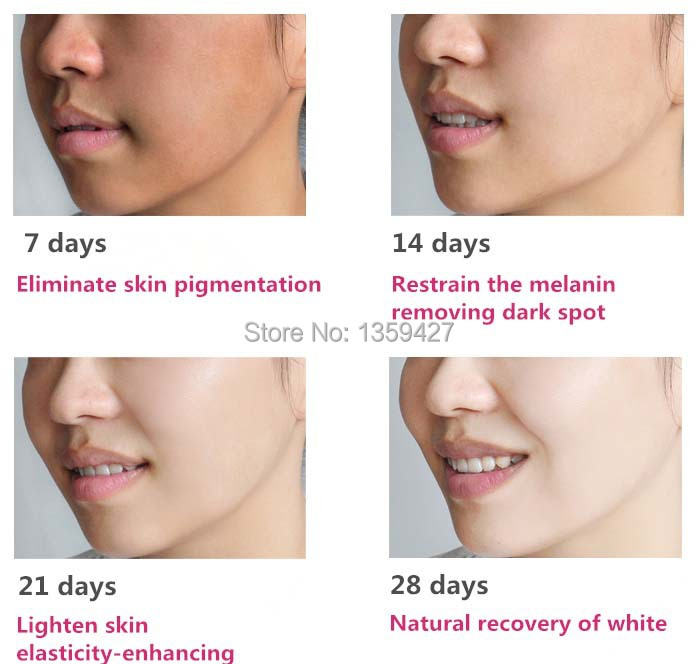 Buy Skin pure lightening effective anti dark spot best face whitening 