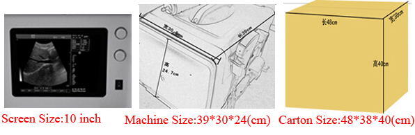 中国xf-218crtフルデジタルポータブル超音波スキャナに使用できますが、 産婦人科を調べる仕入れ・メーカー・工場