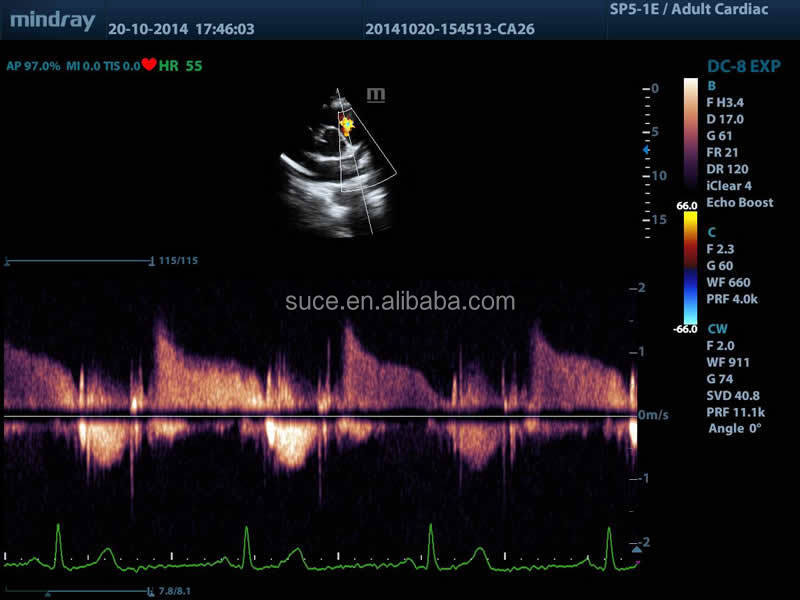 フルデジタルmindray高- グレードカラードップラー超音波診断機器仕入れ・メーカー・工場
