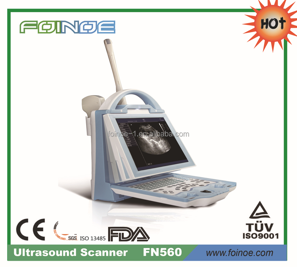 モデル: fn560医療診断機器仕入れ・メーカー・工場