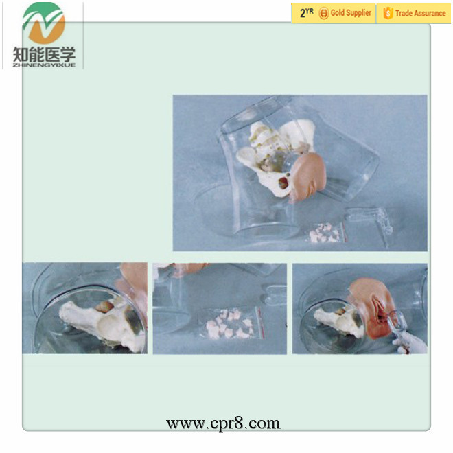 BIX-FT32 Senior transparent  curettage model.jpg