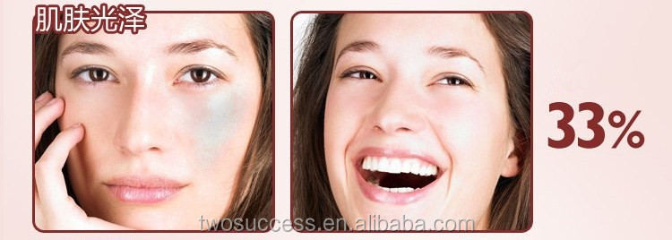 eye wrinkle removal therapy machine for sale for model .jpg