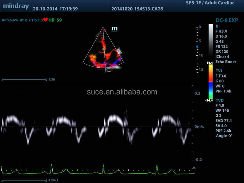 フルデジタルmindray高- グレードカラードップラー超音波診断機器仕入れ・メーカー・工場