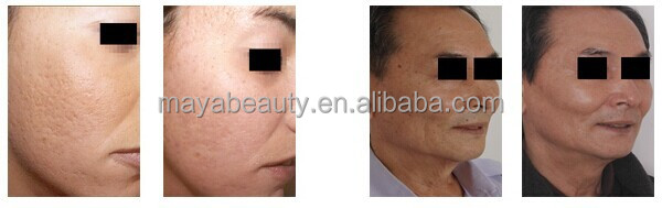 新しいタッチスクリーンmy-500bダイヤモンドチップのmicrodermabrasion/microdermoabrasionマシン、 フェイシャルクリーニング家電( ceは承認された)問屋・仕入れ・卸・卸売り