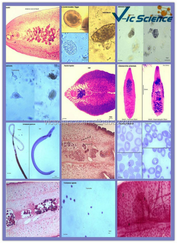 さまざまな種類のparasitology準備顕微鏡のスライドセット問屋・仕入れ・卸・卸売り