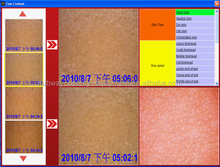 最新の3d2014年皮膚アナライザー( 英語版ソフトウェア)問屋・仕入れ・卸・卸売り