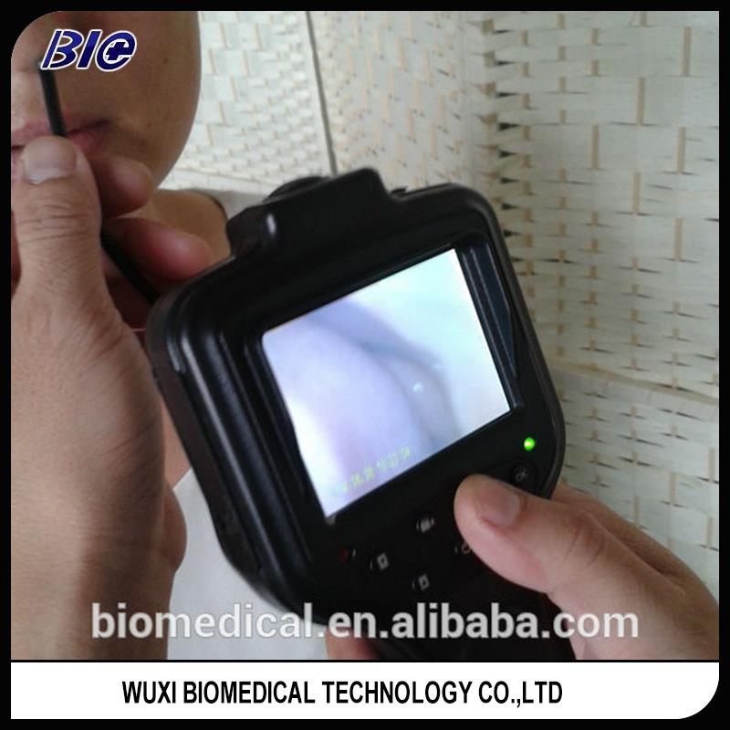 中国デジタルabodominal手術装置usbwifi接続hfc検眼鏡仕入れ・メーカー・工場