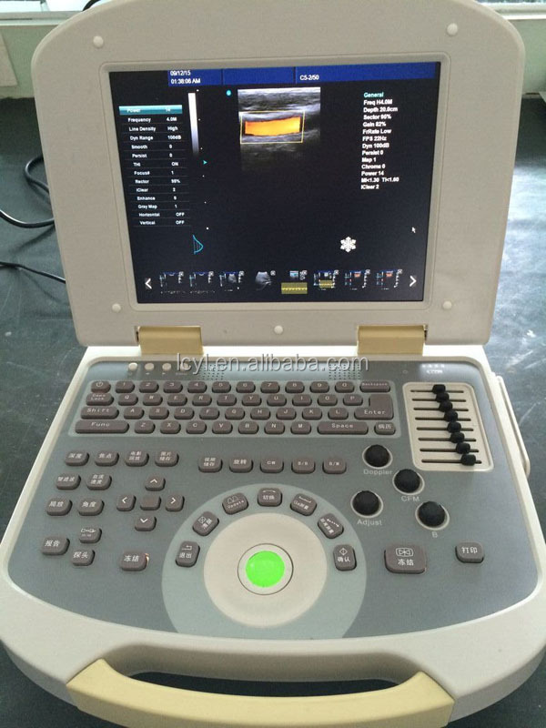 ポータブルカラードップラー超音波機械系15でインチディスプレイ仕入れ・メーカー・工場