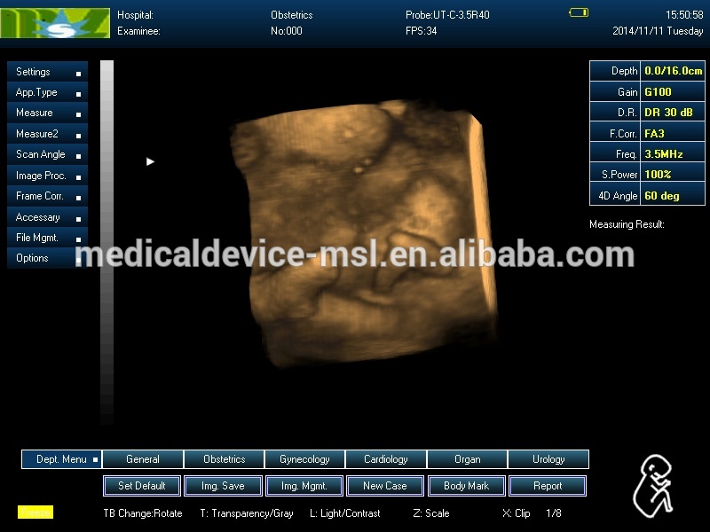 安いメーカー3d/4dmslcu18f価格のラップトップの超音波スキャナの妊娠検査仕入れ・メーカー・工場