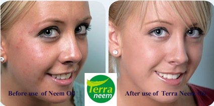 neem oil - cosmetics.jpg