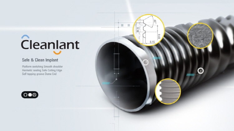 dentiscleanlant歯科インプラントインプラントシステム仕入れ・メーカー・工場