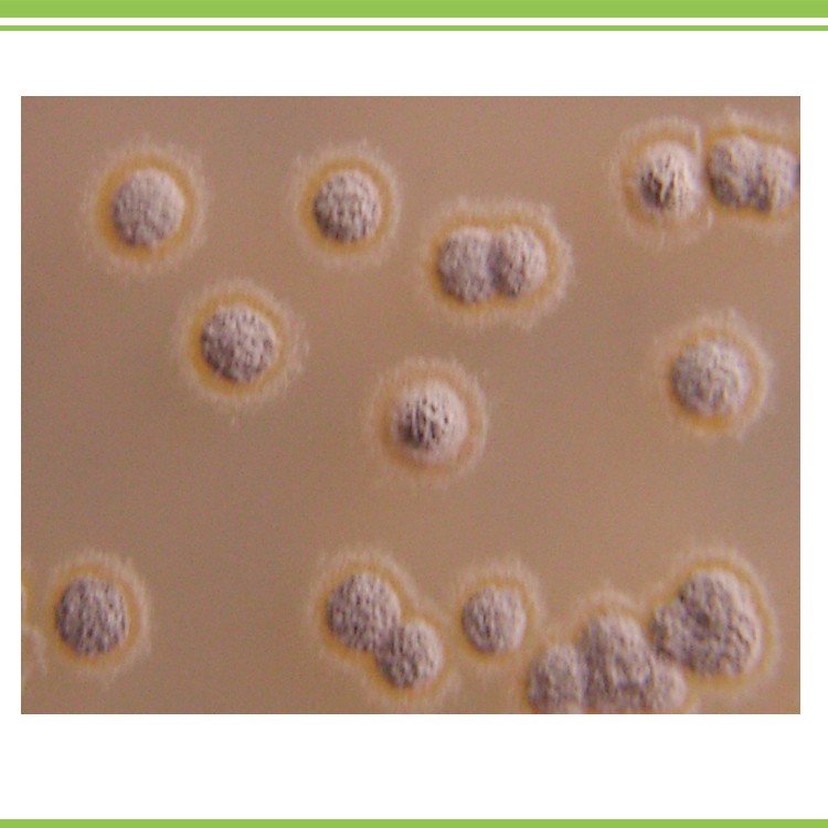 Streptomycetaceae